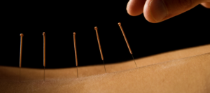Lær om akupunktur